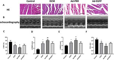 (Pro)renin receptor aggravates myocardial pyroptosis in diabetic cardiomyopathy through AMPK-NLRP3 pathway